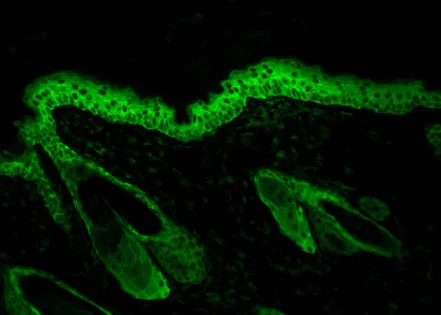 Immunohistochemistry (Formalin/PFA-fixed paraffin-embedded sections) - Anti-Hsp90 beta antibody [H90-10] (AB53497)