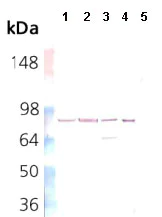 Western blot - Anti-Hsp90 beta antibody [K3701] (AB82584)