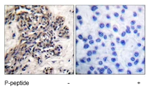 Immunohistochemistry (Formalin/PFA-fixed paraffin-embedded sections) - Anti-Hsp90 beta (phospho S254) antibody (AB51136)