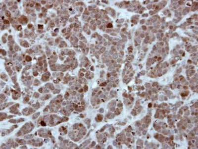 Immunohistochemistry (Formalin/PFA-fixed paraffin-embedded sections) - Anti-HSPA1L antibody (AB154409)