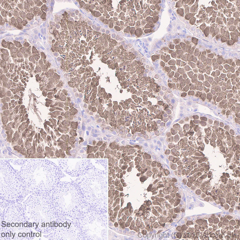 Immunohistochemistry (Formalin/PFA-fixed paraffin-embedded sections) - Anti-HSPA2 antibody [EPR4596] (AB108416)