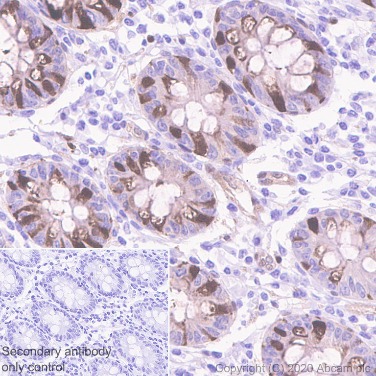 Immunohistochemistry (Formalin/PFA-fixed paraffin-embedded sections) - Anti-HSPA2 antibody [EPR4596] (AB108416)