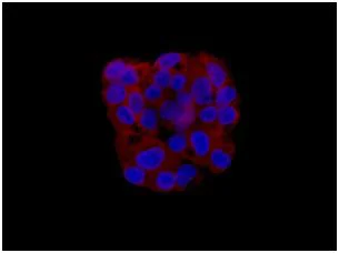 Immunocytochemistry/ Immunofluorescence - Anti-HSPA4 antibody [EPR14166] - BSA and Azide free (AB250864)