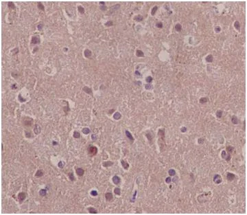 Immunohistochemistry (Formalin/PFA-fixed paraffin-embedded sections) - Anti-HSPA4 antibody [EPR14166] - BSA and Azide free (AB250864)