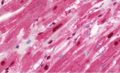 Immunohistochemistry (Formalin/PFA-fixed paraffin-embedded sections) - Anti-HSPA6 antibody (AB212044)