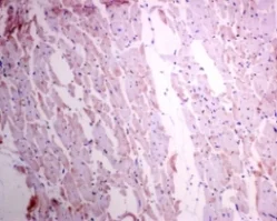 Immunohistochemistry (Formalin/PFA-fixed paraffin-embedded sections) - Anti-HSPB7 antibody [EPR10106(B)] (AB150390)