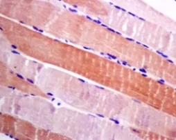 Immunohistochemistry (Formalin/PFA-fixed paraffin-embedded sections) - Anti-HSPB7 antibody [EPR10106(B)] (AB150390)