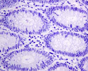 Immunohistochemistry (Formalin/PFA-fixed paraffin-embedded sections) - Anti-HSPB7 antibody [EPR10106(B)] (AB150390)