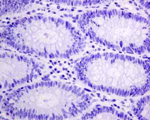 Immunohistochemistry (Formalin/PFA-fixed paraffin-embedded sections) - Anti-HSPB7 antibody [EPR10106(B)] (AB150390)