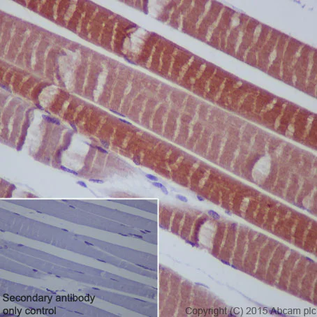 Immunohistochemistry (Formalin/PFA-fixed paraffin-embedded sections) - Anti-HSPB7 antibody [EPR10106(B)] (AB150390)
