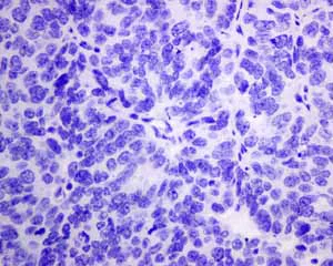 Immunohistochemistry (Formalin/PFA-fixed paraffin-embedded sections) - Anti-HSPB7 antibody [EPR10106(B)] (AB150390)