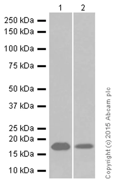 Western blot - Anti-HSPB7 antibody [EPR10106(B)] (AB150390)