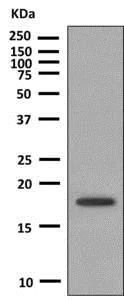 Western blot - Anti-HSPB7 antibody [EPR10106(B)] (AB150390)