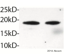 Western blot - Anti-HSPB7 antibody [EPR10106(B)] (AB150390)