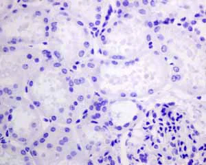 Immunohistochemistry (Formalin/PFA-fixed paraffin-embedded sections) - Anti-HSPB7 antibody [EPR10106(B)] - BSA and Azide free (AB248960)
