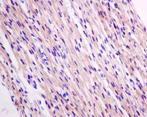 Immunohistochemistry (Formalin/PFA-fixed paraffin-embedded sections) - Anti-HSPB7 antibody [EPR10106(B)] - BSA and Azide free (AB248960)