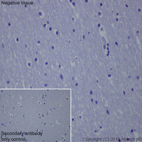 Immunohistochemistry (Formalin/PFA-fixed paraffin-embedded sections) - Anti-HSPB7 antibody [EPR10106(B)] - BSA and Azide free (AB248960)