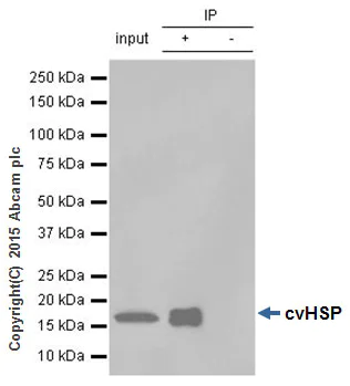 Immunoprecipitation - Anti-HSPB7 antibody [EPR10106(B)] - BSA and Azide free (AB248960)
