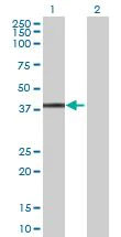 Western blot - HspBP1 overexpression 293T lysate (whole cell) (AB94320)