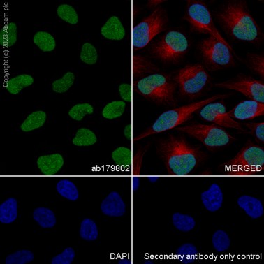 Immunocytochemistry/ Immunofluorescence - Anti-HSPC150/UBE2T antibody [EP9447] (AB179802)