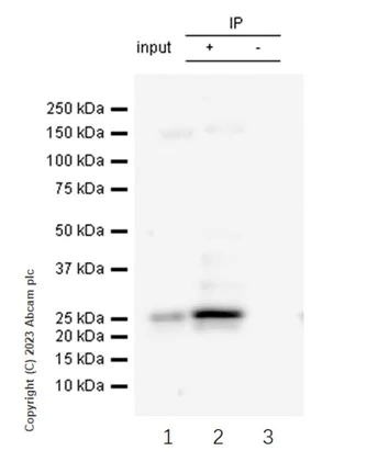 Immunoprecipitation - Anti-HSPC150/UBE2T antibody [EP9447] (AB179802)