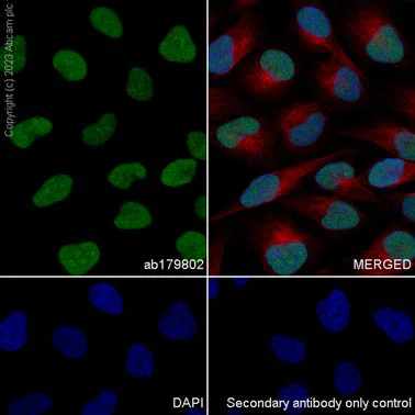 Immunocytochemistry/ Immunofluorescence - Anti-HSPC150/UBE2T antibody [EP9447] - BSA and Azide free (AB284829)