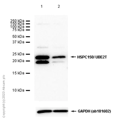 Western blot - Anti-HSPC150/UBE2T antibody [EP9447] - BSA and Azide free (AB284829)