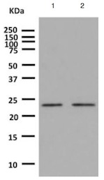 Western blot - Anti-HSPC150/UBE2T antibody [EPR9446] (AB140611)