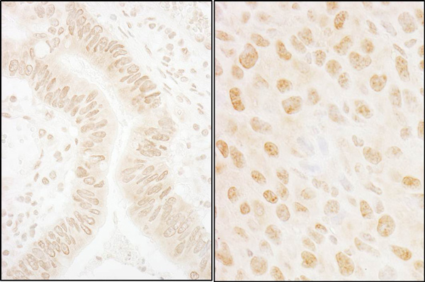 Immunohistochemistry (Formalin/PFA-fixed paraffin-embedded sections) - Anti-hSSB1 antibody (AB85752)