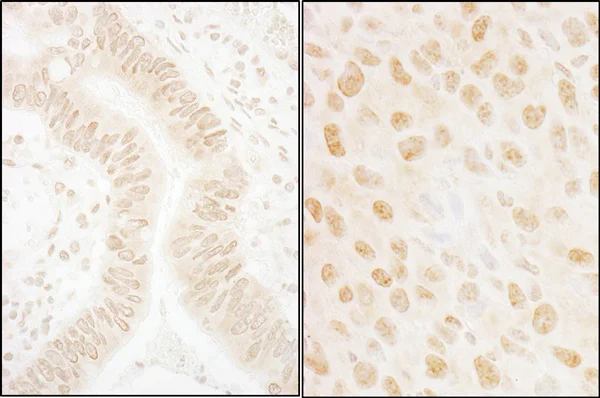 Immunohistochemistry (Formalin/PFA-fixed paraffin-embedded sections) - Anti-hSSB1 antibody (AB85752)