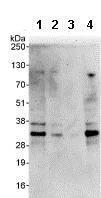 Western blot - Anti-hSSB1 antibody (AB85752)