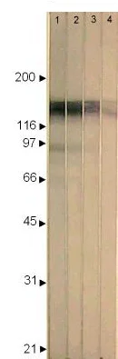 Western blot - Anti-HSV 1 ICP4 Immediate Early Protein antibody [10F1] (AB6514)