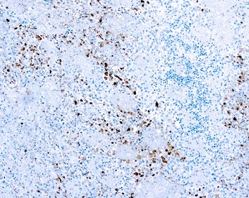 Immunohistochemistry (Formalin/PFA-fixed paraffin-embedded sections) - Anti-HSV1 antibody (AB9533), expandable thumbnail