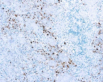 Immunohistochemistry (Formalin/PFA-fixed paraffin-embedded sections) - Anti-HSV1 antibody (AB9533)