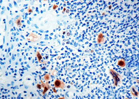 Immunohistochemistry (Formalin/PFA-fixed paraffin-embedded sections) - Anti-HSV1 antibody (AB9533)