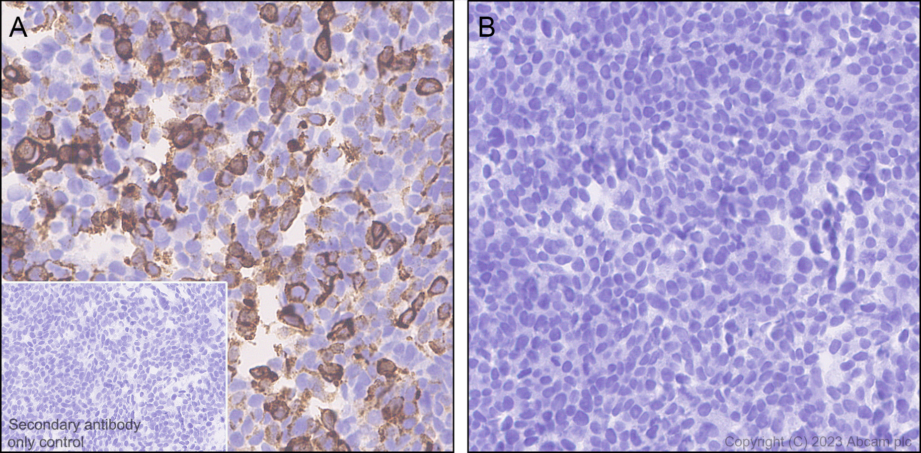 Immunohistochemistry (Formalin/PFA-fixed paraffin-embedded sections) - Anti-HSV1 gH antibody [BBH1] (AB110227), expandable thumbnail