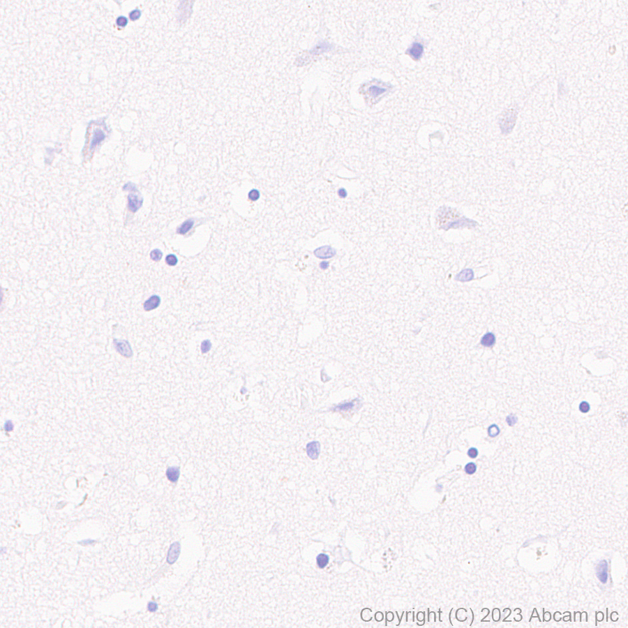 Immunohistochemistry (Formalin/PFA-fixed paraffin-embedded sections) - Anti-HSV1 gH antibody [BBH1] (AB110227), expandable thumbnail