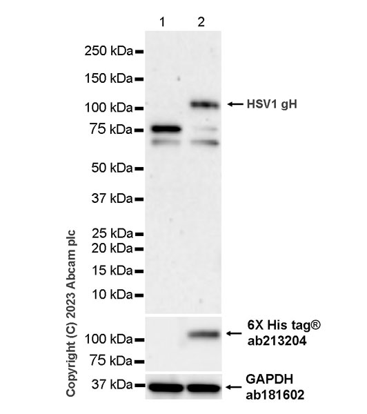 Western blot - Anti-HSV1 gH antibody [BBH1] (AB110227), expandable thumbnail