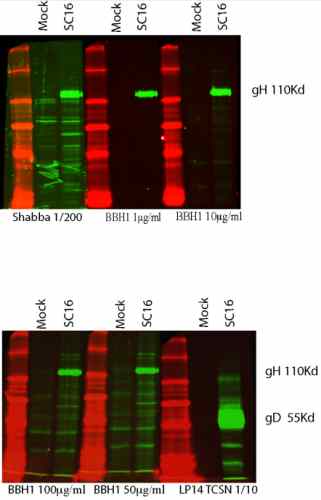 Western blot - Anti-HSV1 gH antibody [BBH1] (AB110227), expandable thumbnail