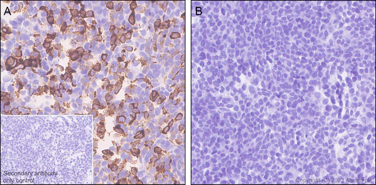 Immunohistochemistry (Formalin/PFA-fixed paraffin-embedded sections) - Anti-HSV1 gH antibody [BBH1] - BSA and Azide free (AB314235)
