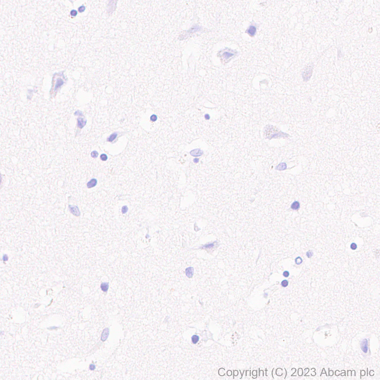 Immunohistochemistry (Formalin/PFA-fixed paraffin-embedded sections) - Anti-HSV1 gH antibody [BBH1] - BSA and Azide free (AB314235)