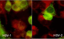 Immunocytochemistry/ Immunofluorescence - Anti-HSV1 + HSV2 gB antibody [10B7] (AB6506)