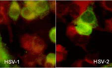 Immunocytochemistry/ Immunofluorescence - Anti-HSV1 + HSV2 gB antibody [10B7] (AB6506)