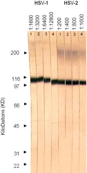 Western blot - Anti-HSV1 + HSV2 gB antibody [10B7] (AB6506)