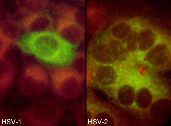 Immunocytochemistry/ Immunofluorescence - Anti-HSV1 + HSV2 gD antibody [2C10] (AB6507)