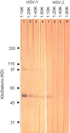 Western blot - Anti-HSV1 + HSV2 gD antibody [2C10] (AB6507)