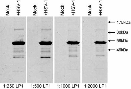 Western blot - Anti-HSV1 + HSV2 VP16 antibody [LP1] (AB110226)