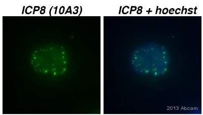 Immunocytochemistry/ Immunofluorescence - Anti-HSV1 ICP8 Major DNA binding protein antibody [10A3] (AB20193), expandable thumbnail