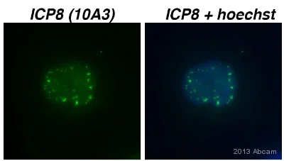 Immunocytochemistry/ Immunofluorescence - Anti-HSV1 ICP8 Major DNA binding protein antibody [10A3] (AB20193)