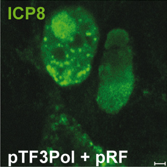 Immunocytochemistry/ Immunofluorescence - Anti-HSV1 ICP8 Major DNA binding protein antibody [11E2] (AB20194)